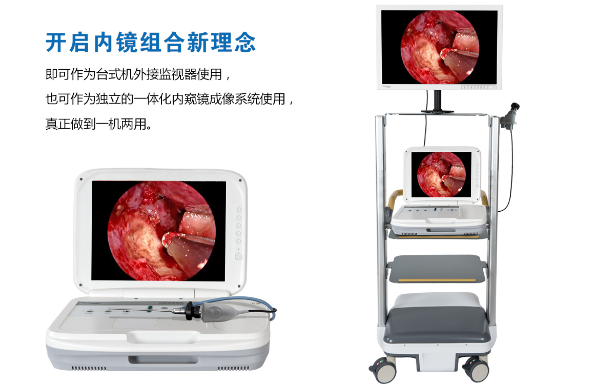 用戶反饋：YKD-9003內窺鏡攝像機獲得好評